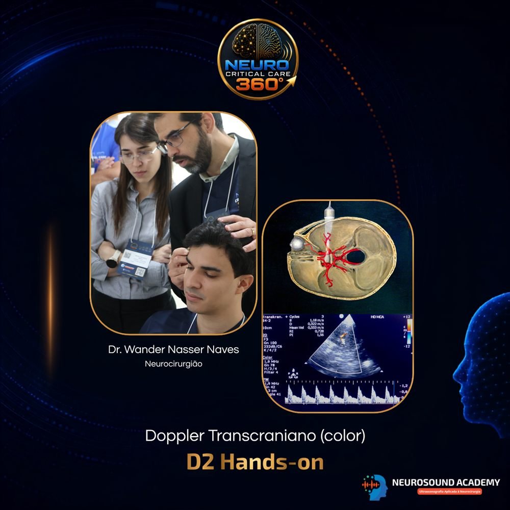 Estação de Doppler Transcraniano — D2 Hands-on